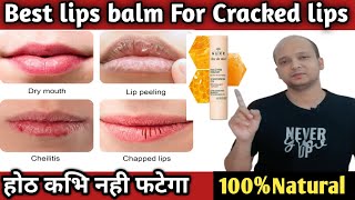 Best Lip Balm For Dry Cracked And Chapped Lips🤩 [upl. by Eelano]