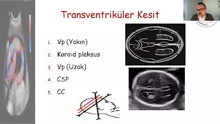 Detaylı Ultrason Taraması [upl. by Akeemat]