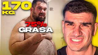 La Cruda Realidad de la OBESIDAD MÓRBIDA💀 Problemas de Pesar 170KG [upl. by Coray]