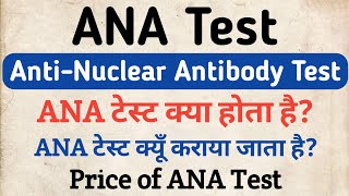 ANA Test in hindi  Antinuclear Antibody Test  ANAAntibody Test [upl. by Miksen]