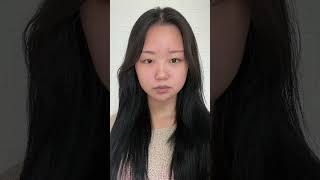 Korean girl before and after double eyelid surgery [upl. by Zoara]