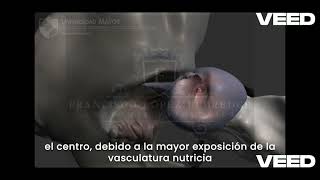 Patología del Sistema Osteoarticular  Parte 6 Displasia de Cadera en Caninos CDD [upl. by Aixela]