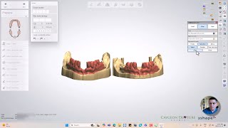 How To Align Models in 3Shape Dental Designer 2024 [upl. by Ydroj721]