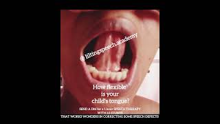 USE ORAL MOTOR THERAPY TO CORRECT ORAL MOTOR DYSFUNCTION WITHIN 6 MONTHS new speechtherapy tongue [upl. by Nylecoj]