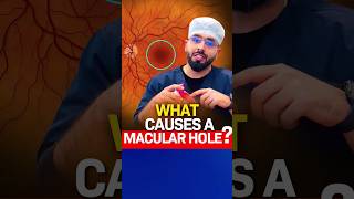 What causes a Macular Hole [upl. by Jessabell]