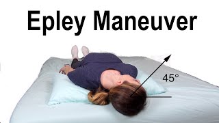 Epley Maneuver to Treat BPPV Dizziness [upl. by Atsyrc924]