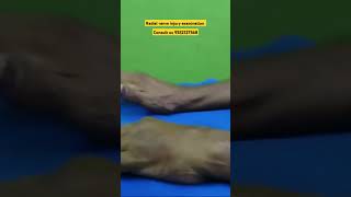 Radial nerve injury Examination pain finger physiotherapy anatomy ruhs nims aims [upl. by Peggie199]