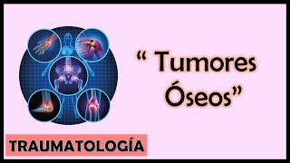 Tumores Óseos [upl. by Rudolf]