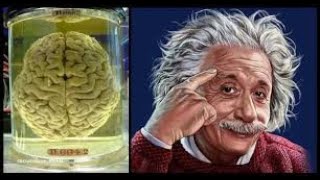 How Albert Einsteins Brain was Different [upl. by Aniat]