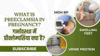 PRE ECLAMPSIA PREGNANCY INDUCED HYPERTENSIVE DISORDERdr Seema kale [upl. by Dianne]