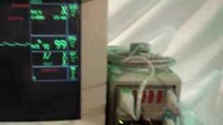 GE Marquette Solar 8000 Patient Monitor [upl. by Anileuqcaj]