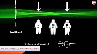 Q5 Will I still need glasses after cataract surgery [upl. by Ttocserp]