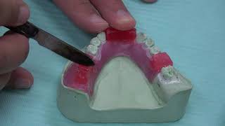 Acrylic Partial Denture  MMR optech [upl. by Jung911]