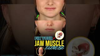 Fix your Jaw muscle Exercises [upl. by Lered]