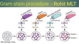 Gram stain procedure gram staining steps gram positive and gram negative [upl. by Alomeda446]