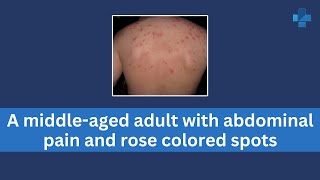 A middle aged adult with abdominal pain and rose colored spots [upl. by Einor]