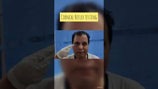 corneal reflex testing  trigeminal nerve  facial nerve clinical shorts [upl. by Odlaner463]