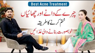 Pimples and Acne Treatment At Home  Skin Care Routine  Dr Huria Arooj  Dr AR Madha [upl. by Alidis278]