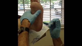 Injection for heel spur plantar fasciitis [upl. by Lamag451]