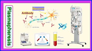 plasmapheresis [upl. by Somar777]
