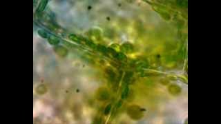 Práctica observación ciclosis Cellular cyclosis in Elodea canadensis [upl. by Killy]