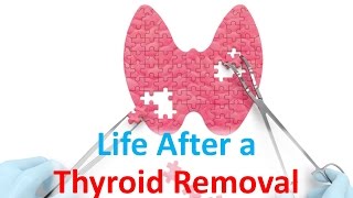 Life After a Thyroid Removal [upl. by Ina]