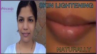 How To Brighten Skin Naturally  treatment for Dark LipsAcne SpotsSun Tan  SuperPrincessjo [upl. by Gigi]