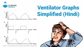 Ventilator Graphics Class  1 Simplified [upl. by Ased]