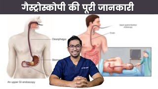 Is Gastroscopy Painful Cost Side Effects Safety Explained  Dr Vishal Tomar  Open Consult [upl. by Ykcim221]