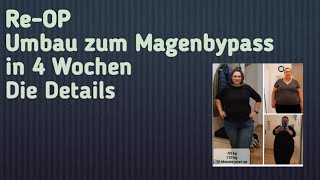 Schlauchmagen Umbau zum Magenbypass alle Details Magenbypass umbauschlauchmagen [upl. by Meri]