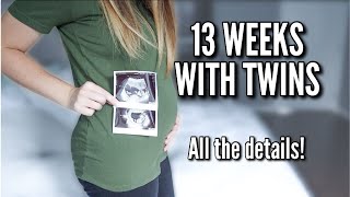 PREGNANCY UPDATE  13 WEEKS WITH TWINS [upl. by Kylstra888]