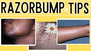 How to Get rid of Razor Bumps Ingrown hairs [upl. by Rinum99]