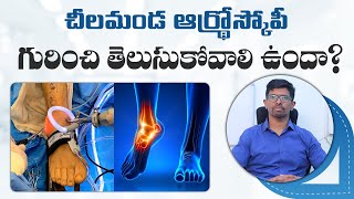 What is Ankle Arthoscopy  Ankle Arthroscopic Examination  Dr Vamshis Orthopaedic Center [upl. by Schaaff]