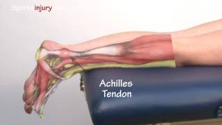 Achilles Tendonitis  Tendinopathy  Explained in 90 Seconds [upl. by Lynnett621]