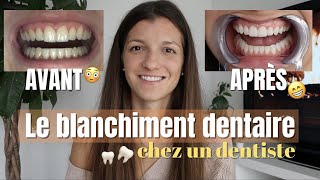 BLANCHIMENT DENTAIRE chez le dentiste prix durée sensibilité [upl. by Naihr248]