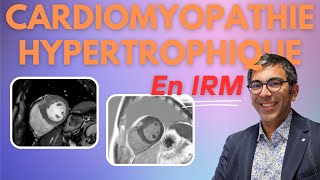 Cardiomyopathie Hypertrophique CMH en IRM  lessentiel en 11 minutes [upl. by Litsyrk]