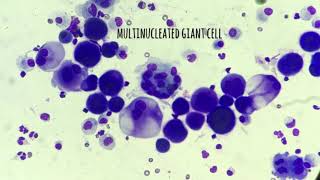 Multinucleated giant cell [upl. by Minne888]