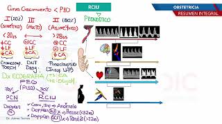 Obstetricia  RCIU [upl. by Darcey]