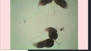 Drosophila Ovarian Dissection for Immunohistochemistry [upl. by Halden734]