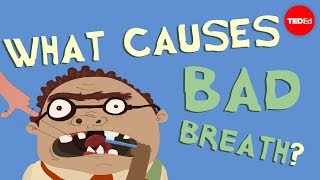 What causes bad breath  Mel Rosenberg [upl. by Fisch]