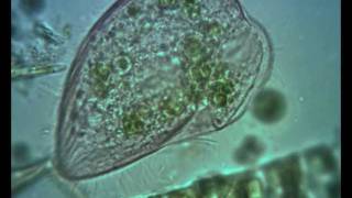 Blepharisma ciliate Contractile Vacuole in Action [upl. by Anegroeg]