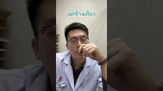 ยา Risperidone part22 เทรนด์วันนี้ antipsychotics schizophrenia จิตเภท ซึมเศร้า [upl. by Kama]