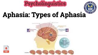 Aphasia  Types of Aphasia [upl. by Giacobo]