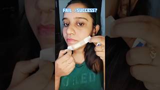 ഇതൊരു LIFE CHANGING HACK ആകുമോ gooys😱 ashortaday pimple skincareroutine shabzbeautyworld [upl. by Annairoc]