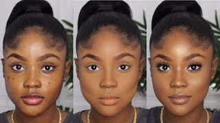 HOW TO COVER UP BREAKOUTS amp SCARS WITHOUT LOOKING CAKEY OR ASHYKAISERCOBY [upl. by Lunn622]