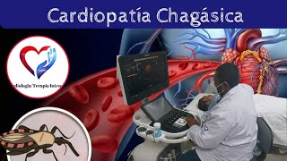 CardiopatÍa chagásica [upl. by Myk963]