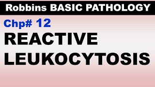 Ch12  Reactive Leukocytosis  EBV Infection  Infectious Mononucleosis  Blood Pathology [upl. by Einon]