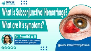 Subconjunctival Hemorrhage Blood in Eye  Symptoms Signs amp Causes of Subconjunctival Hemorrhage [upl. by Obau]