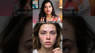 चेहऱ्यावरील मुरूम व पुळ्या जाण्यासाठी उत्तम उपाय  Best acne prone skin solution [upl. by Spence664]