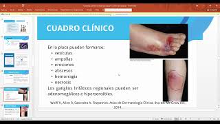 Erisipela Celulitis Impetigo [upl. by Jocelyn745]